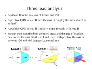 Ecg basics | PPT