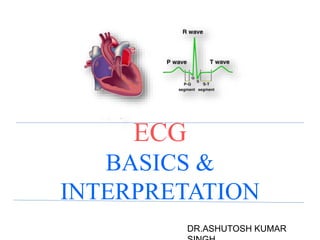 ECG
BASICS &
INTERPRETATION
DR.ASHUTOSH KUMAR
 