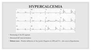 ECG BASICS.pptx