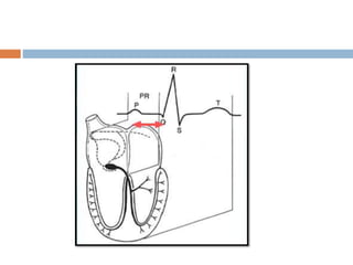 ECG basics.ppt