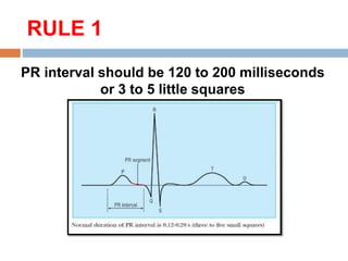 Pr Interval Ruler ECG basics.ppt