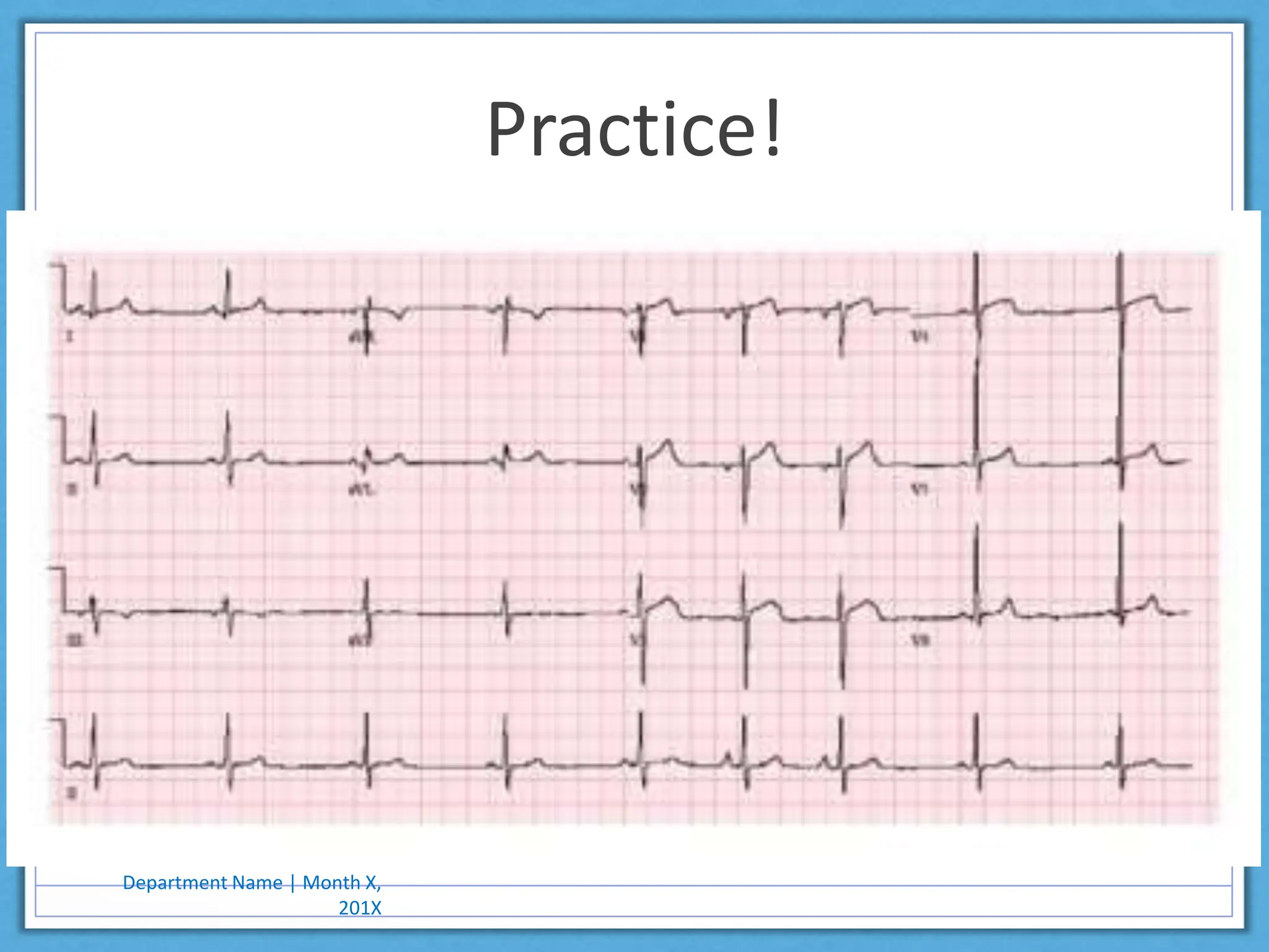 ECG Basics.pptx