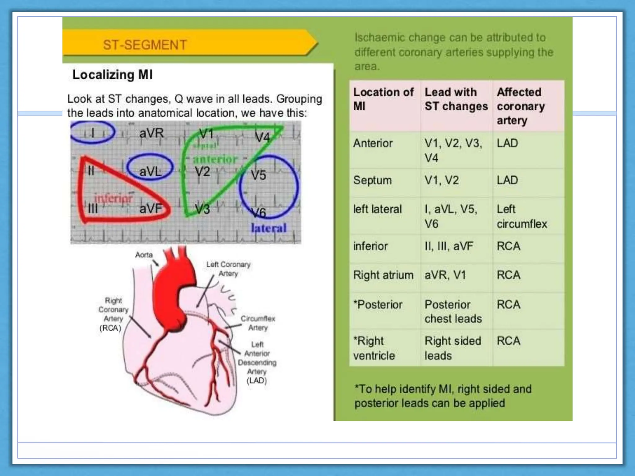 ECG Basics.pptx