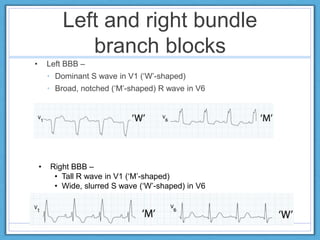 ECG Basics.pptx