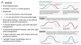 ecg basics for physiotherapy students reference purpose | PPTX