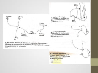 ECG BASICS PPT | PPTX