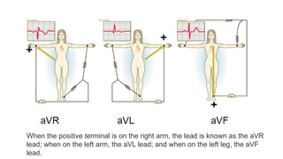 ECG basics powerpoint presentation slides | PPTX