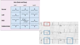 ECG basics powerpoint presentation slides | PPTX