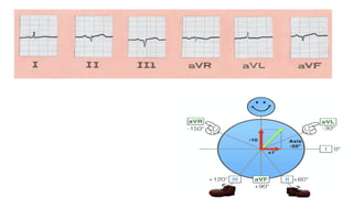 ECG basics powerpoint presentation slides | PPTX
