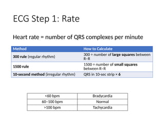 Comprehensive ECG Basics and Acute Coronary Syndrome Interpretation | PPTX