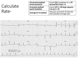 Comprehensive ECG Basics and Acute Coronary Syndrome Interpretation | PPTX