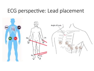 Comprehensive ECG Basics and Acute Coronary Syndrome Interpretation | PPTX