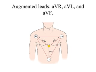 Ecg basics 1 | PPT