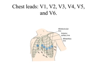 Chest leads: V1, V2, V3, V4, V5,
and V6.
 
