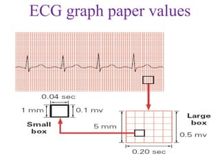 ECG graph paper values
 