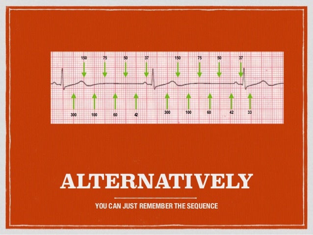 Ecg Basics 3 Pdf Ecg Basics 3 Pdf