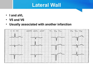 ECG Basics and fundamentals Best for Basic infromation | PPT