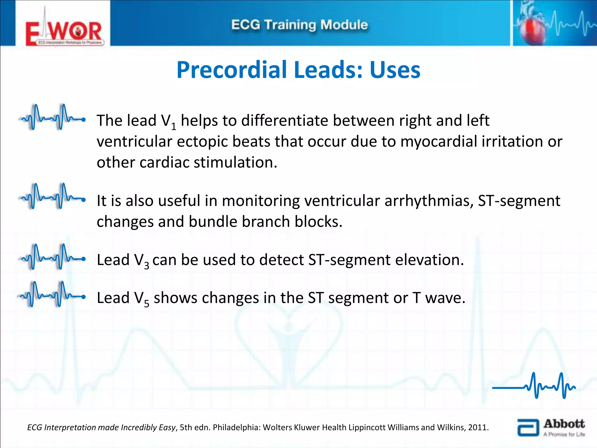 Ecg basics and interpretation | PPTX