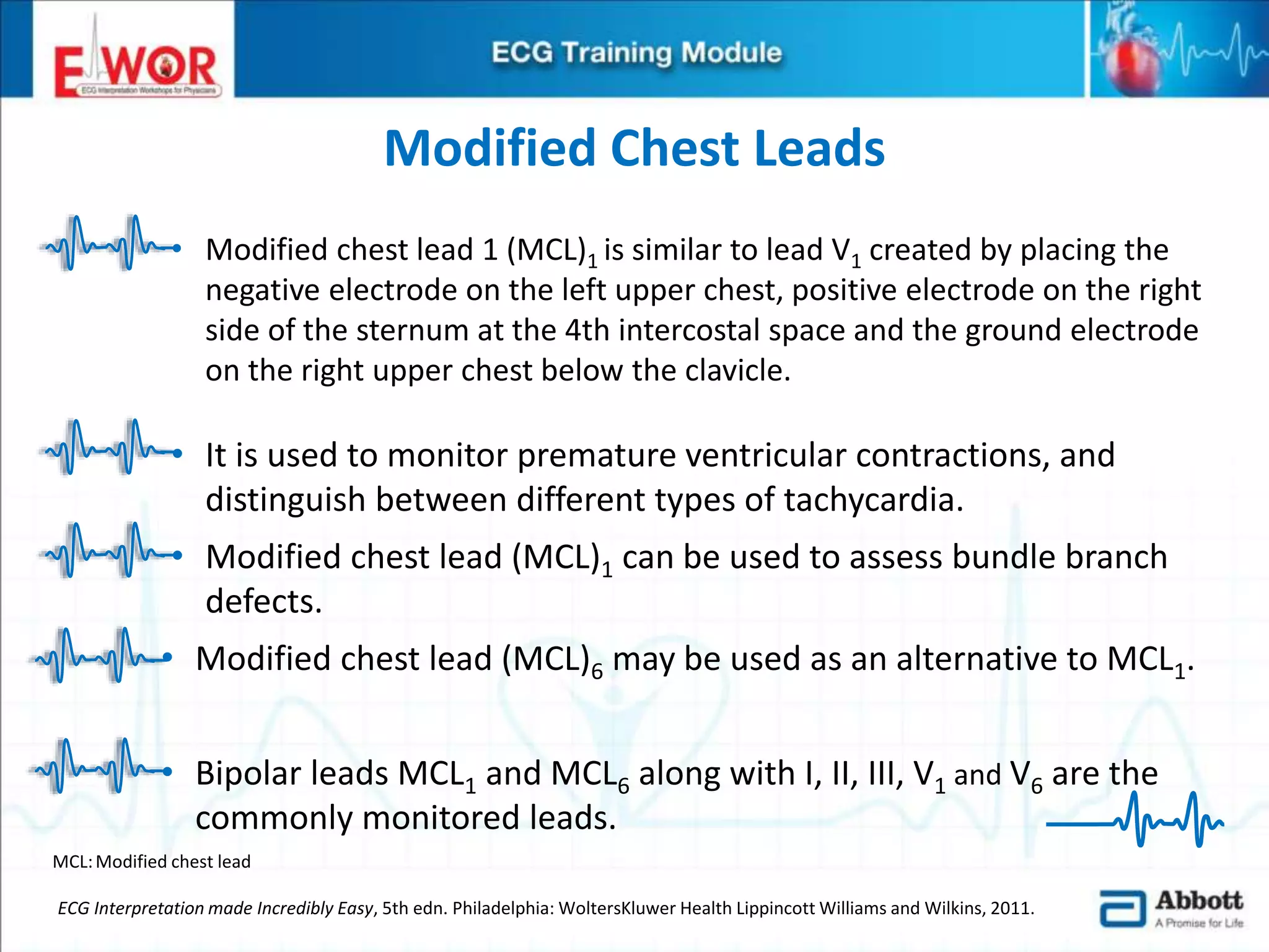 Ecg basics and interpretation | PPTX