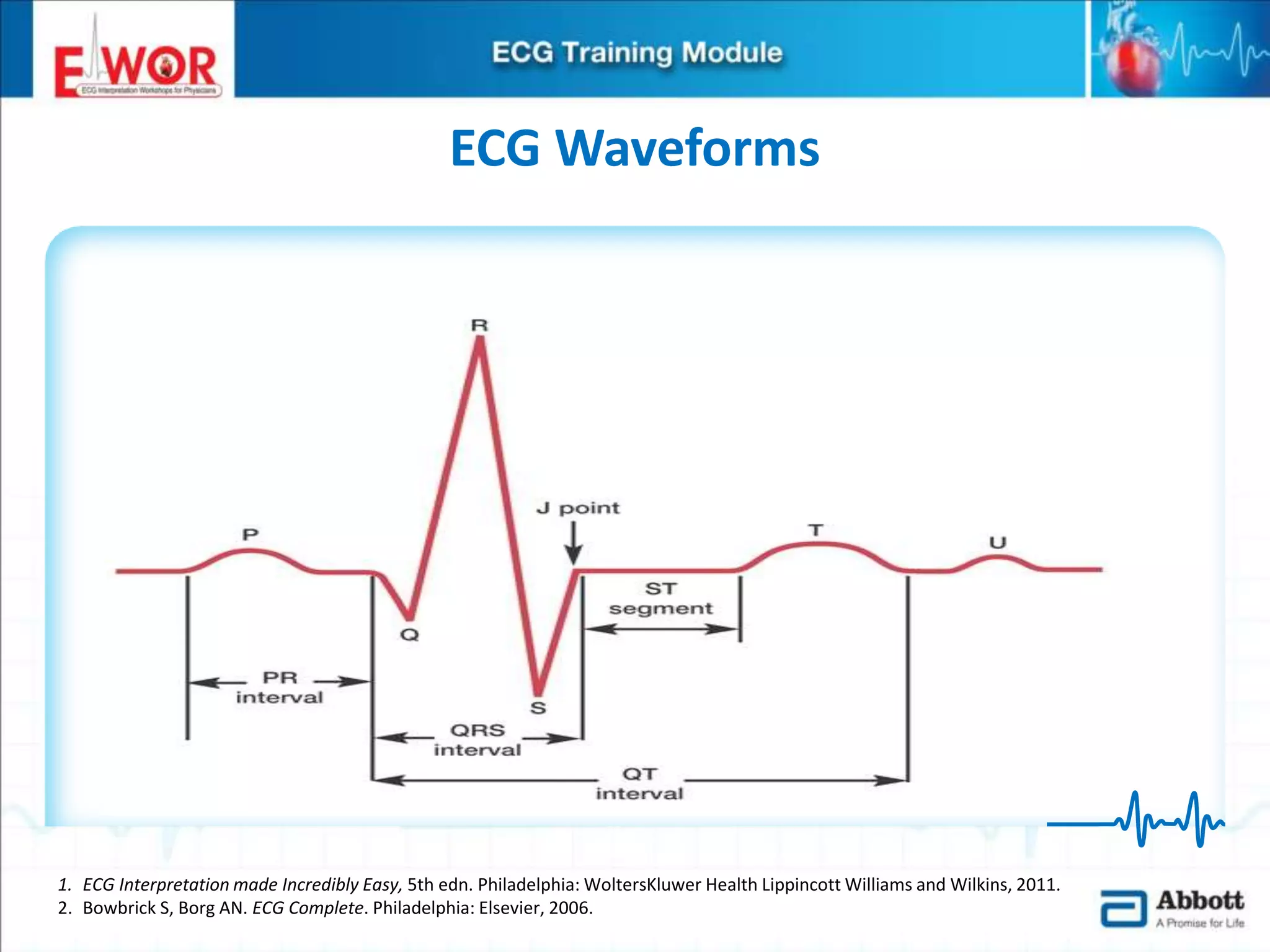 Ecg basics and interpretation | PPTX