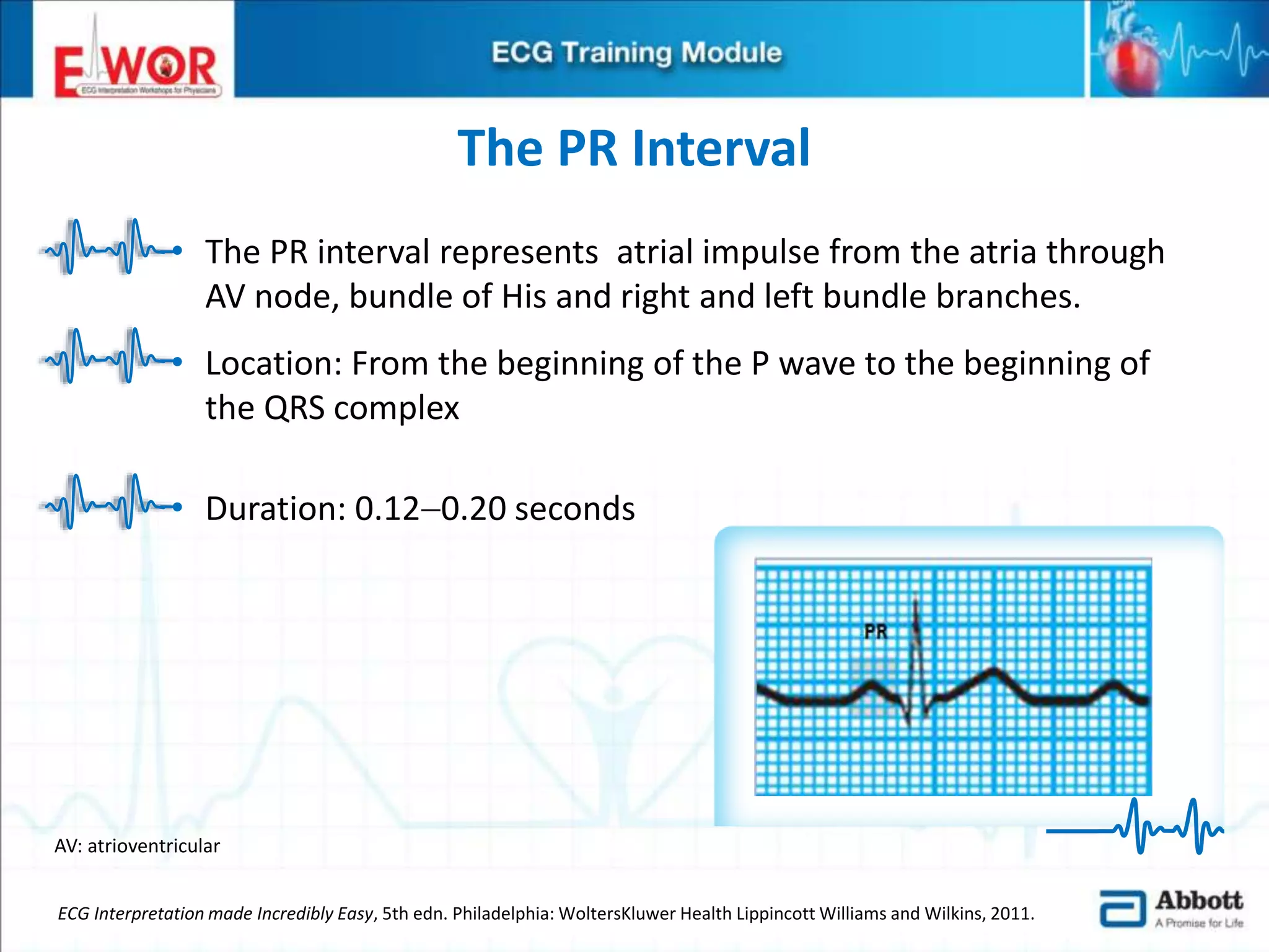 Ecg basics and interpretation | PPTX