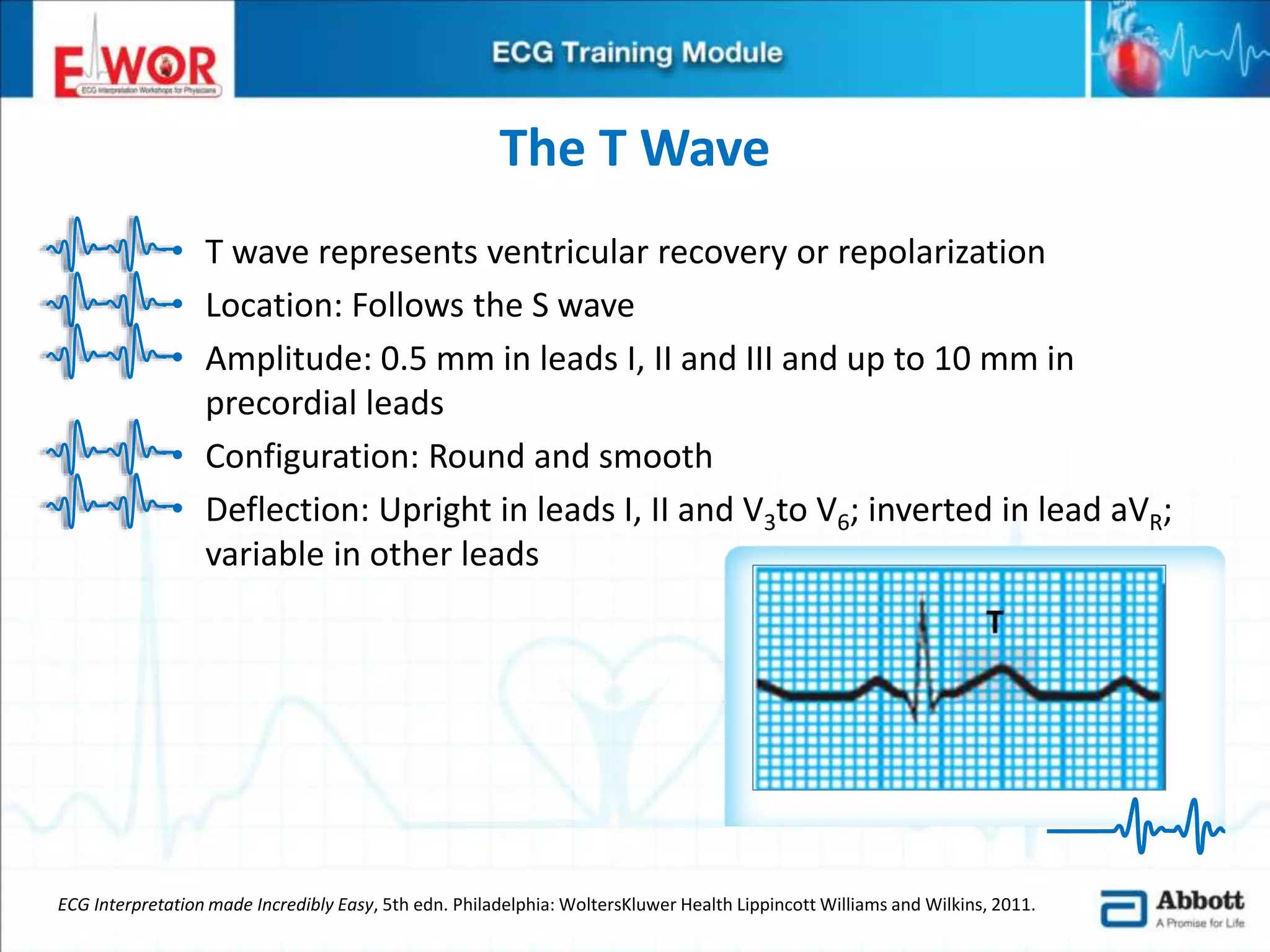 Ecg basics and interpretation | PPTX