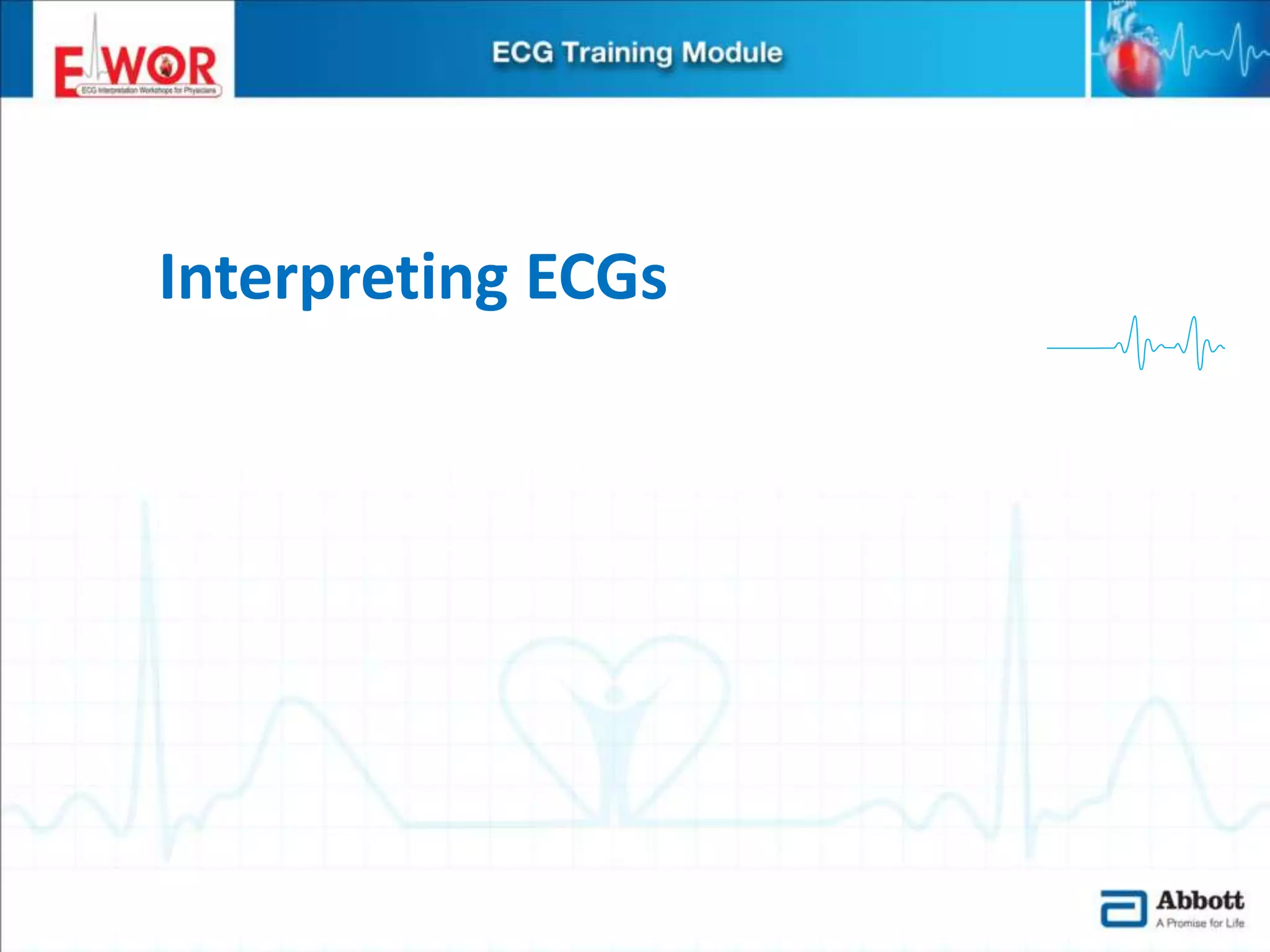 Ecg basics and interpretation | PPTX