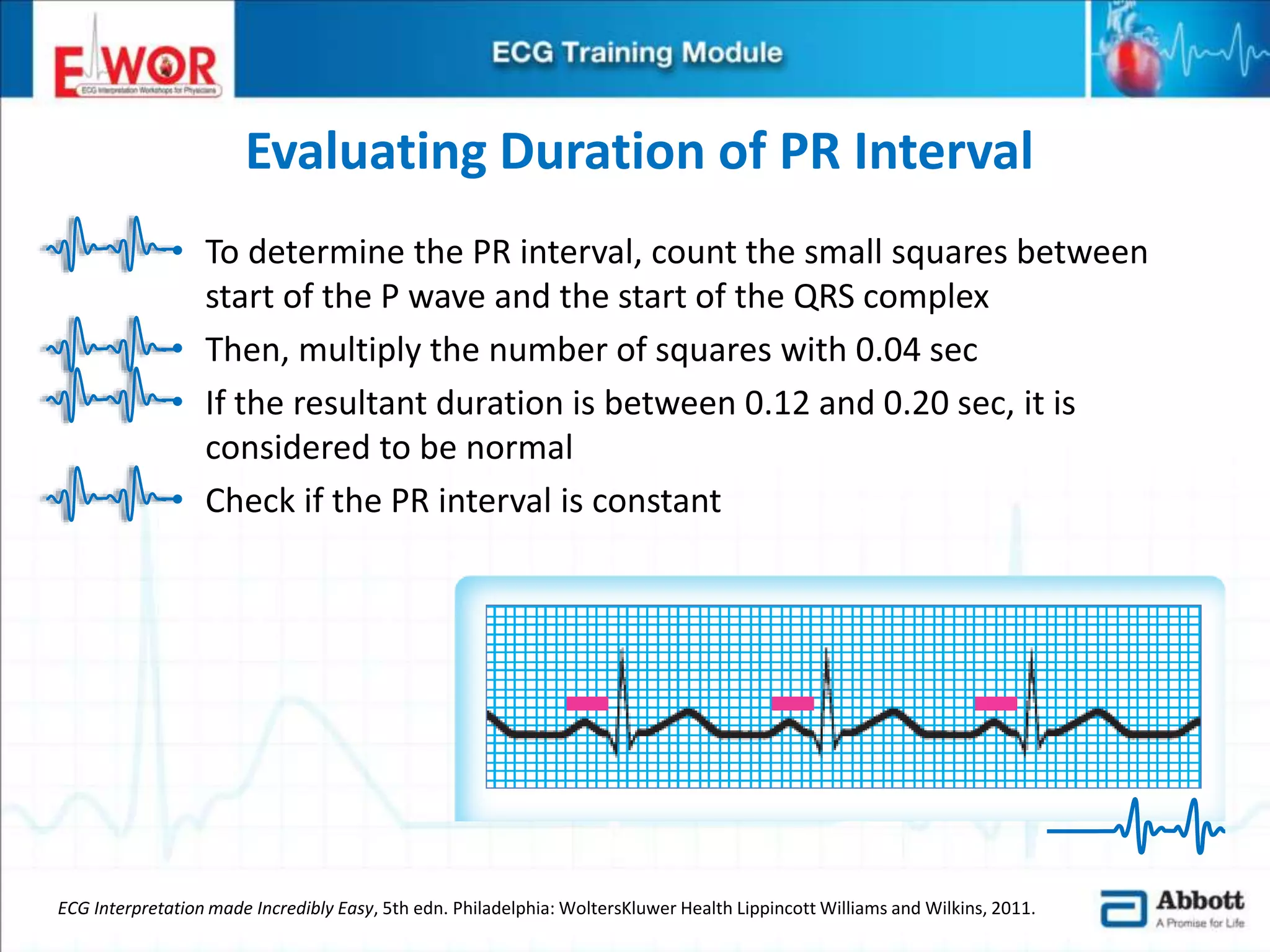 Ecg basics and interpretation | PPTX