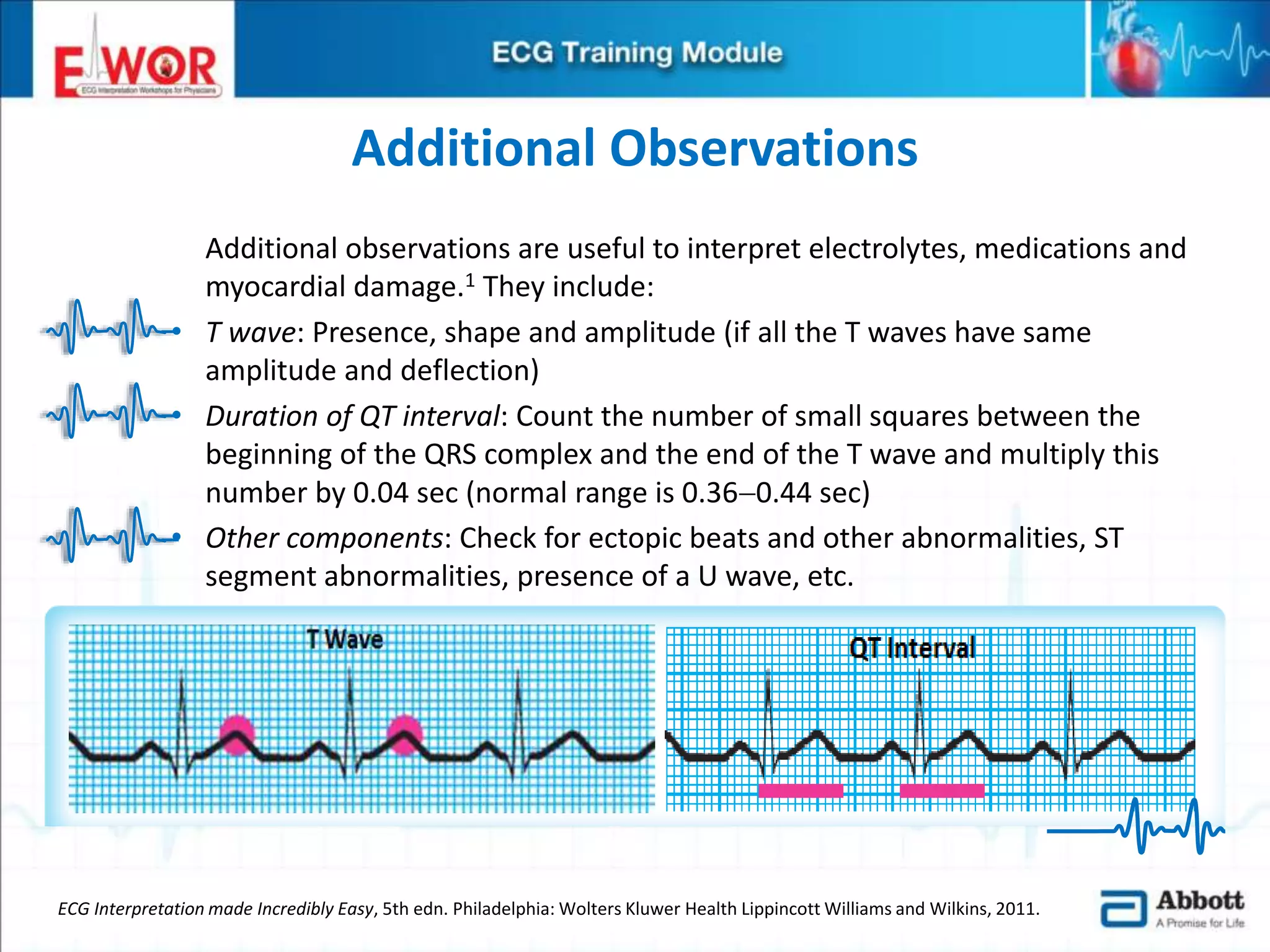 Ecg basics and interpretation | PPTX