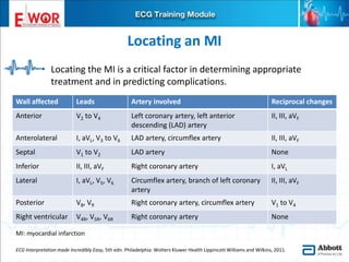Localizing Mi Ecg basics and interpretation | PPTX
