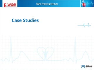 Ecg basics and interpretation | PPTX