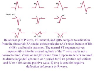 Relationship of P wave, PR interval, and QRS complex to activation
from the sinoatrial (SA) node, atrioventricular (AV) node, bundle of His
(HIS), and bundle branches. The normal ST segment curves
imperceptibly into the ascending limb of the T wave and is not a
horizontal line. Variation in QRS wave form. Uppercase letters are used
to denote large defl ection; R or r is used for fi rst positive defl ection;
and R′ or r′ for second positive wave. Q or q is used for negative
deflection before an r or R wave.
 