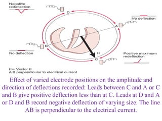 Effect of varied electrode positions on the amplitude and
direction of deflections recorded: Leads between C and A or C
and B give positive deflection less than at C. Leads at D and A
or D and B record negative deflection of varying size. The line
AB is perpendicular to the electrical current.
 