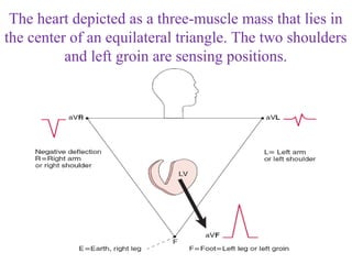 The heart depicted as a three-muscle mass that lies in
the center of an equilateral triangle. The two shoulders
and left groin are sensing positions.
 