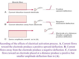 Recording of the effects of electrical activation process. A, Current flows
toward the electrode produce a positive upward deflection. B, Current
flows away from the electrode produce a negative deflection. C, Current
flows toward an electrode placed at a distance produce a positive but
smaller amplitude deflection than in (A).
 
