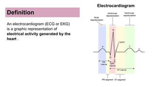 Define Ecg ECG basics finaaaaaaaaaaaaaaaaaaaaaaaaaaal.pptx
