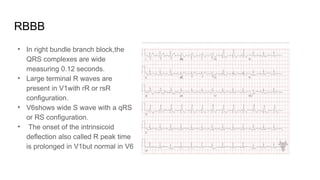 ECG basics finaaaaaaaaaaaaaaaaaaaaaaaaaaal.pptx
