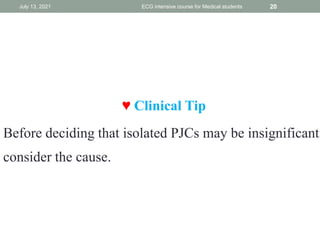 ♥ Clinical Tip
Before deciding that isolated PJCs may be insignificant,
consider the cause.
July 13, 2021 ECG intensive course for Medical students 20
 