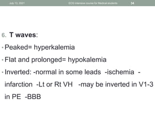 6. T waves:
• Peaked= hyperkalemia
• Flat and prolonged= hypokalemia
• Inverted: -normal in some leads -ischemia -
infarction -Lt or Rt VH -may be inverted in V1-3
in PE -BBB
July 13, 2021 ECG intensive course for Medical students 34
 