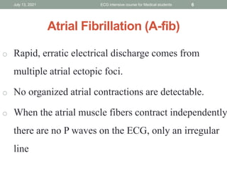 July 13, 2021 ECG intensive course for Medical students 6
Atrial Fibrillation (A-fib)
o Rapid, erratic electrical discharge comes from
multiple atrial ectopic foci.
o No organized atrial contractions are detectable.
o When the atrial muscle fibers contract independently
there are no P waves on the ECG, only an irregular
line
 
