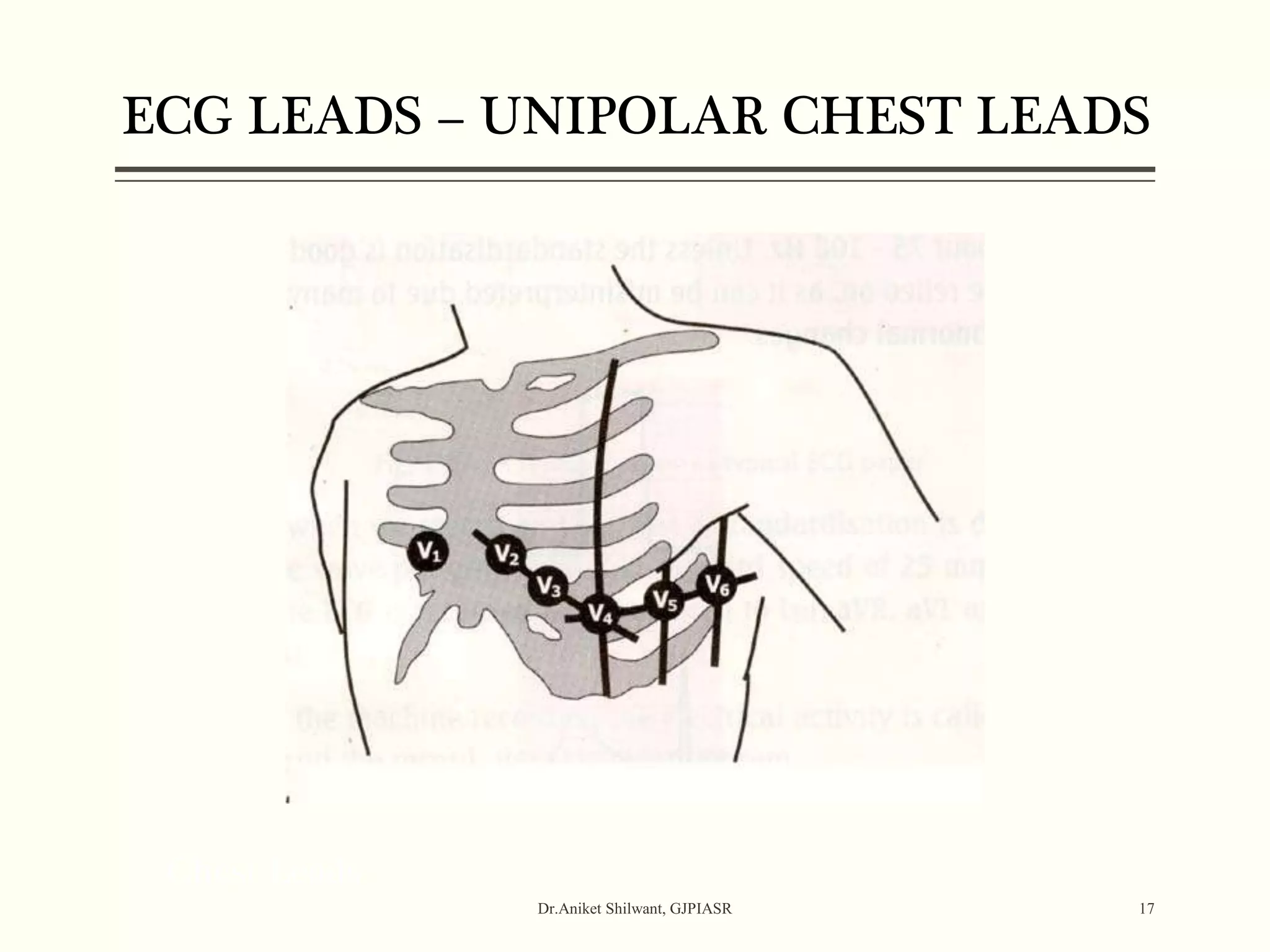 Chest Leads
Dr.Aniket Shilwant, GJPIASR 17
ECG LEADS – UNIPOLAR CHEST LEADS
 