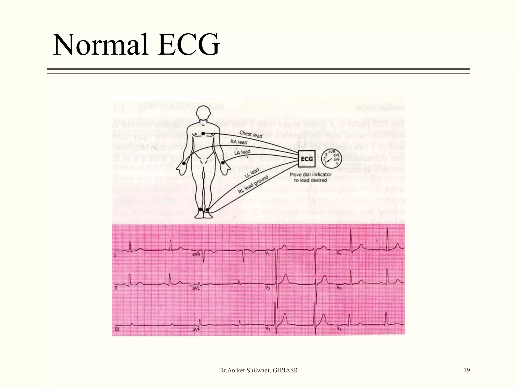Normal ECG
Dr.Aniket Shilwant, GJPIASR 19
 