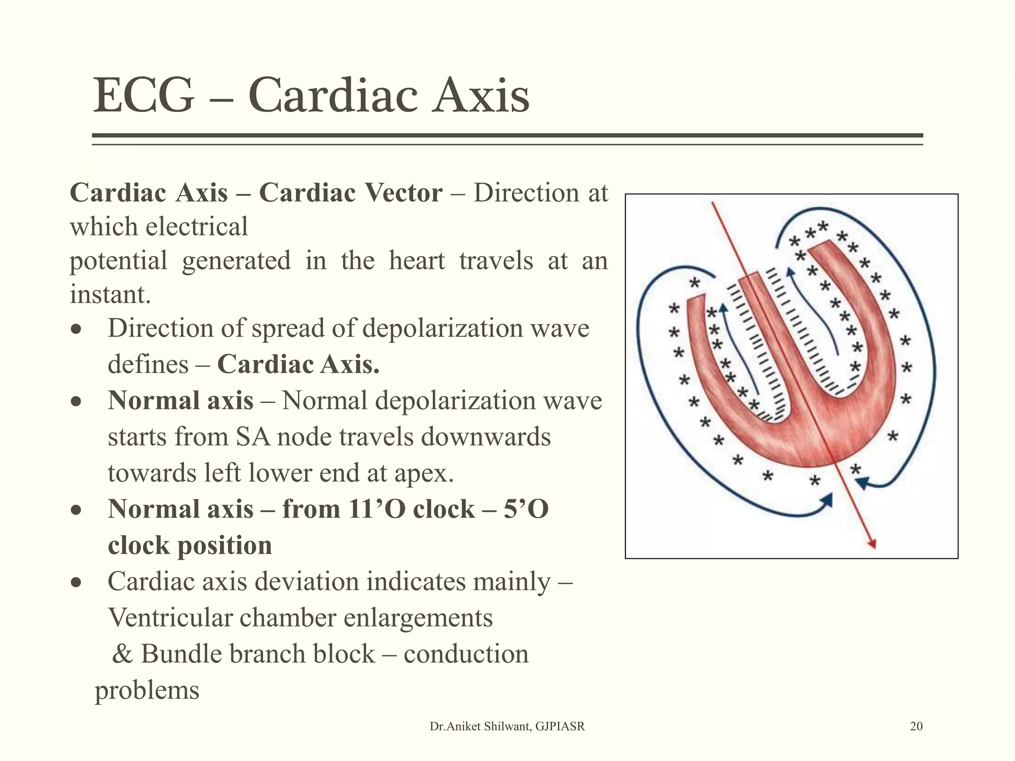 ECG – Cardiac Axis
Dr.Aniket Shilwant, GJPIASR 20
Cardiac Axis – Cardiac Vector – Direction at
which electrical
potential generated in the heart travels at an
instant.
 Direction of spread of depolarization wave
defines – Cardiac Axis.
 Normal axis – Normal depolarization wave
starts from SA node travels downwards
towards left lower end at apex.
 Normal axis – from 11’O clock – 5’O
clock position
 Cardiac axis deviation indicates mainly –
Ventricular chamber enlargements
& Bundle branch block – conduction
problems
 