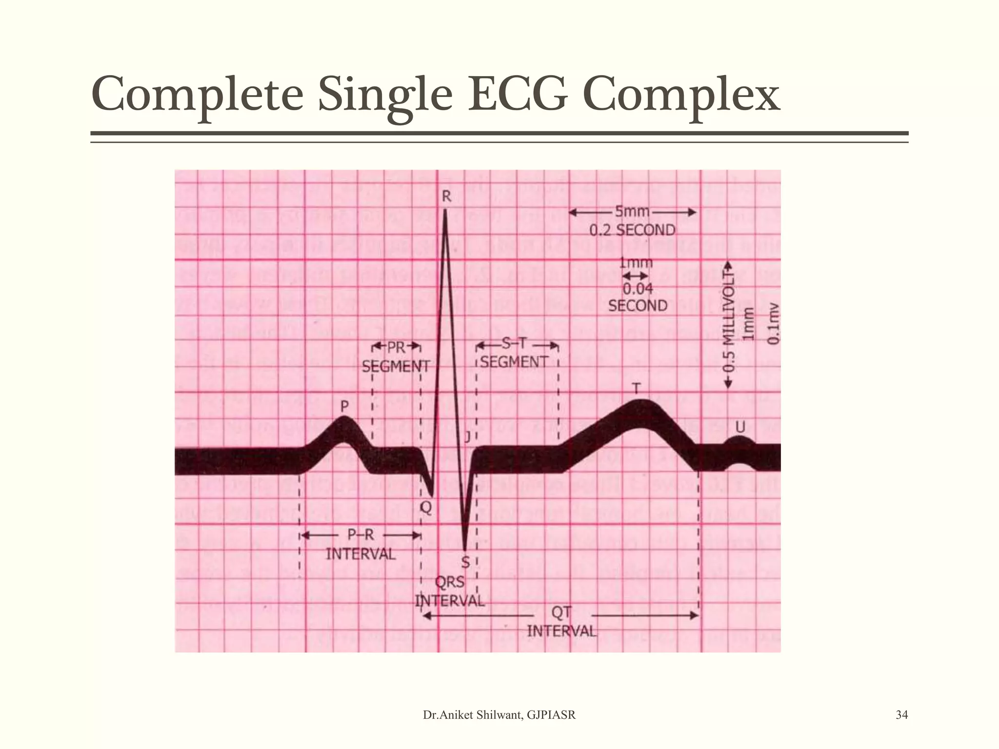 Complete Single ECG Complex
Dr.Aniket Shilwant, GJPIASR 34
 