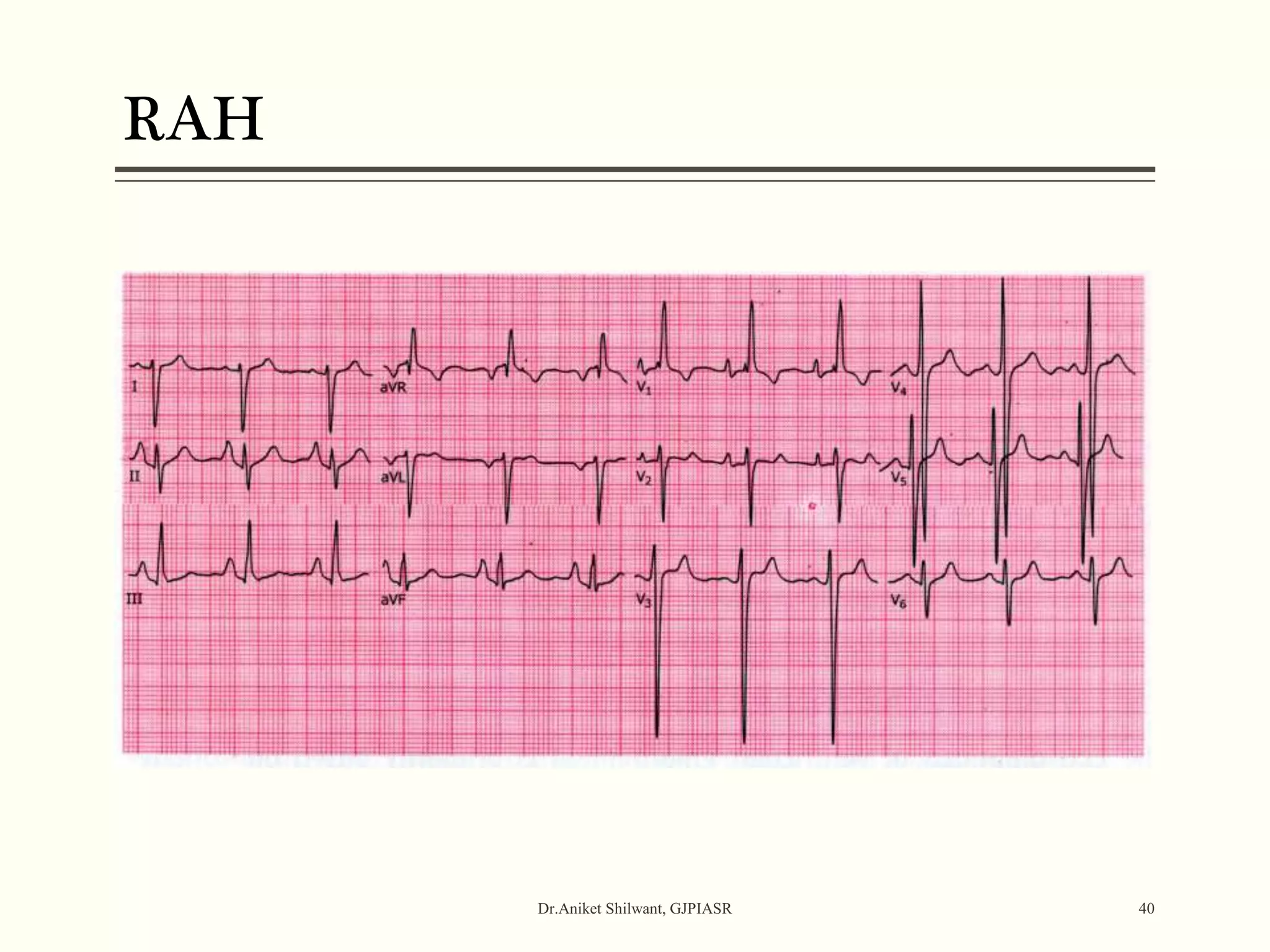 RAH
Dr.Aniket Shilwant, GJPIASR 40
 