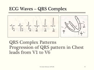 ECG BASICS | PPT