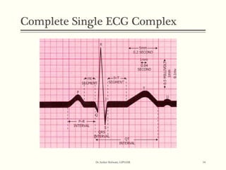 ECG BASICS | PPT