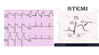 ECG BASICS PRESENTATION .pptx