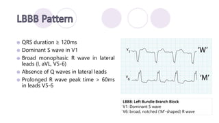 ECG Basics with Dr LK Meher.pptx