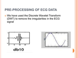 PRE-PROCESSING OF ECG DATA
 We have used the Discrete Wavelet Transform
(DWT) to remove the irregularities in the ECG
signal
17
 